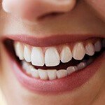 Person with flawless teeth smiling after periodontal therapy