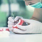 Custom dental implant supported dentures