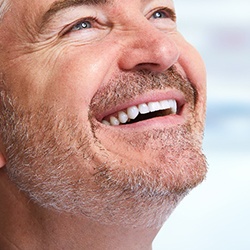 Man with a dental bridge in Grapevine