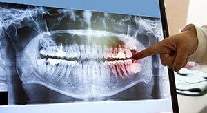 dental X-ray of teeth