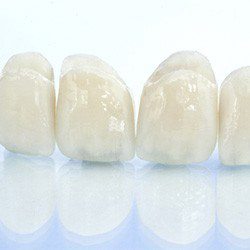 Dental crowns in Grapevine