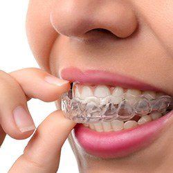 woman putting in Invisalign trays