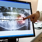 digital x-ray of teeth