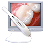 teeth displayed with intraoral camera