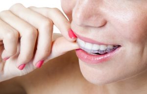 woman smiling white teeth 