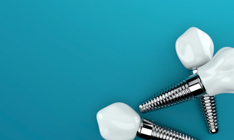 examples of dental implants